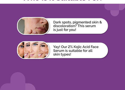 The Derma Co 2% Kojic Acid Face Serum With 1% Alpha Arbutin & Niacinamide For Dark Spots & Pigmentation, 30 ml (Pack of 1)